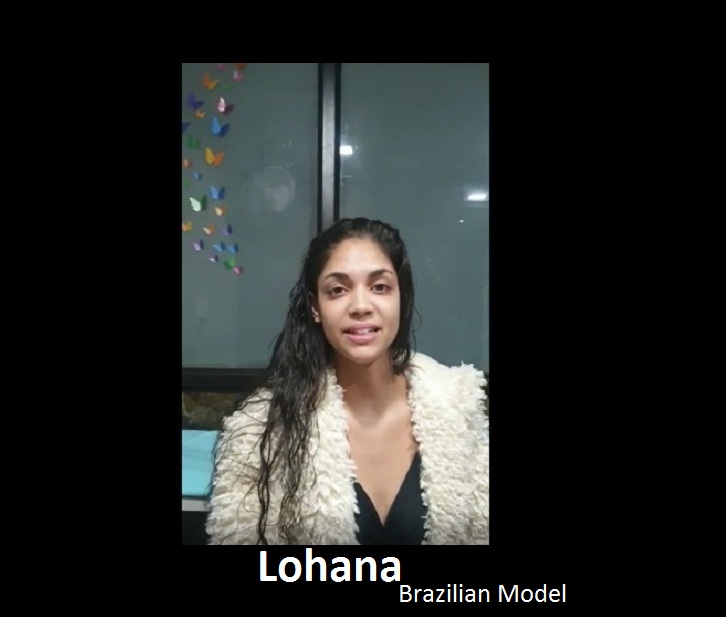 Patient Review - Lohana (Brazilian Model)
