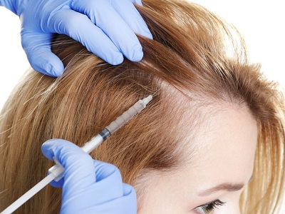 PRP Therapy In Noida for Hair Loss